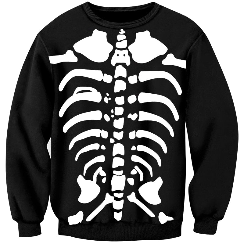 broken bones
